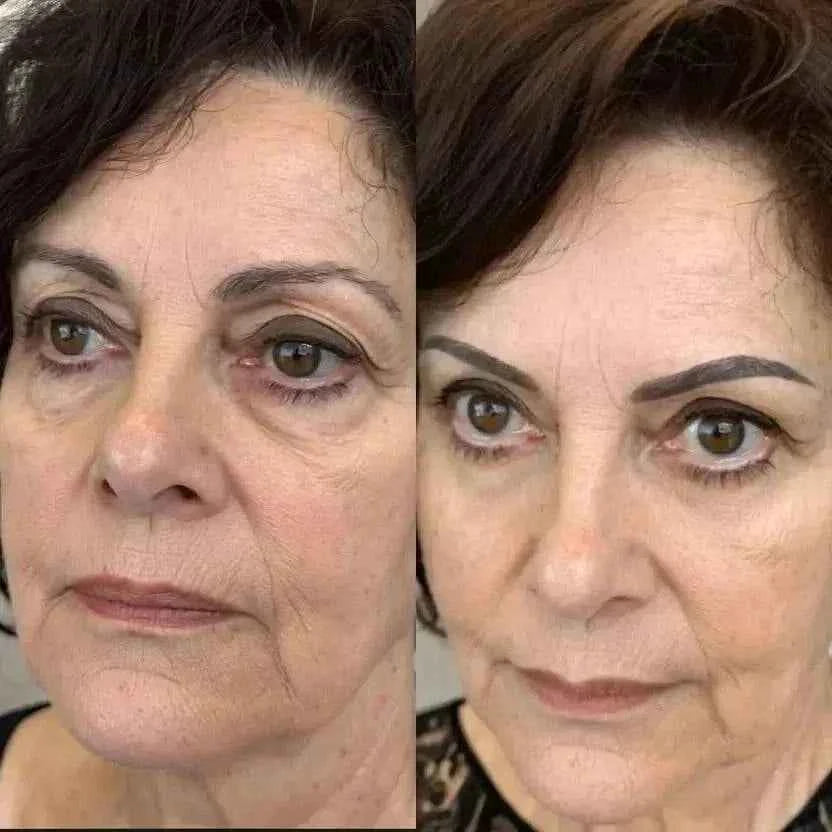 Dispositif RevitalEyes® UrbanHeight avec lumière rouge et EMS pour réduire les poches sous les yeux, vue de face.